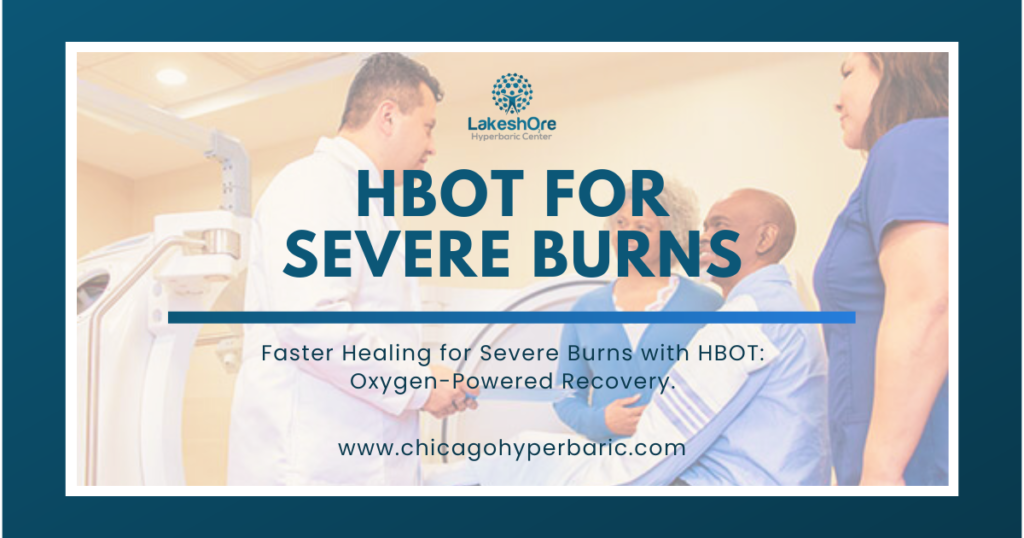 Hyperbaric Oxygen Therapy for Severe Burns: Burn Healing With HBOT